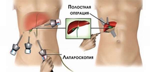 Восстановление после операции