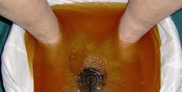 Ванночка для ног с йодом