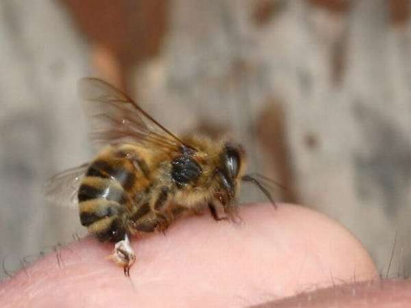 Пчела жалит человека
